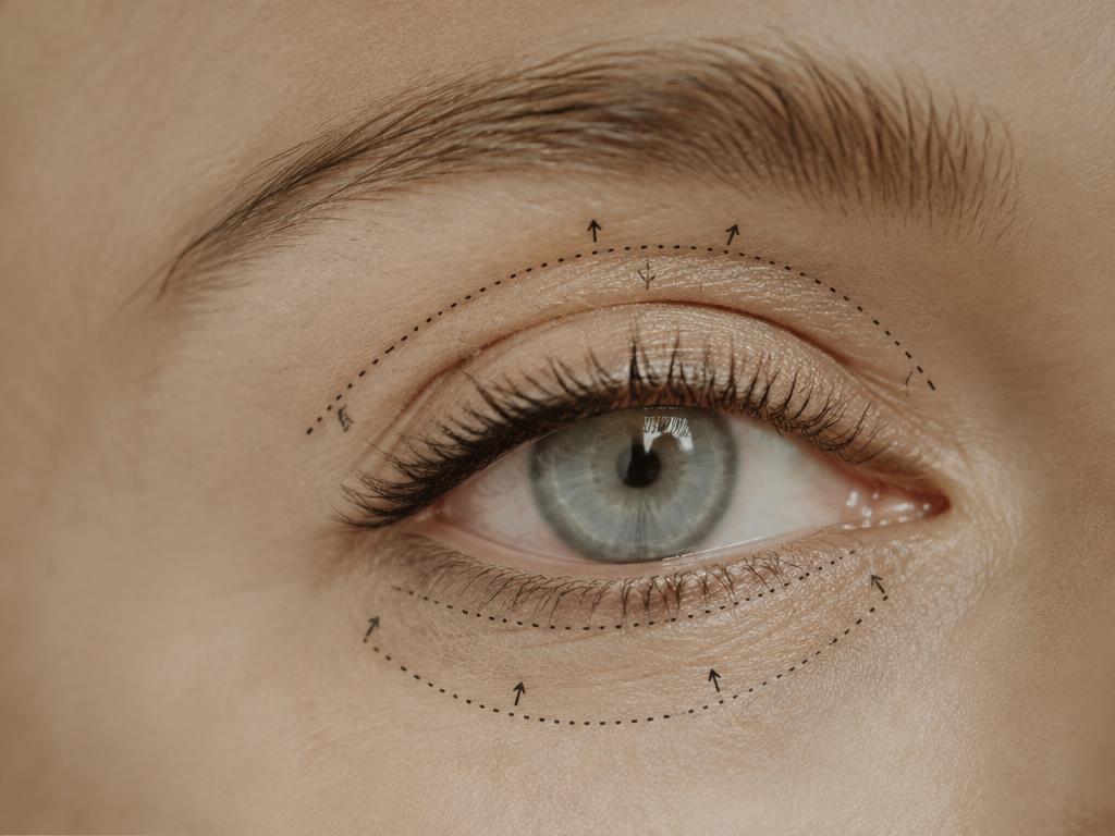 LASIK